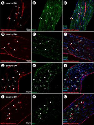 Pericyte-derived cells participate in optic nerve scar formation